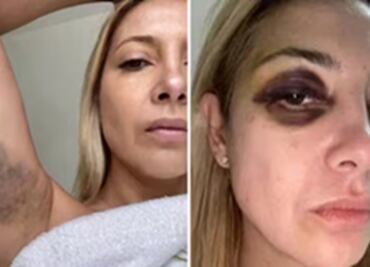 Difunden fotos y mensajes que Fabiola Yáñez, expareja de Alberto Fernández, presentó ante la justicia por violencia machista