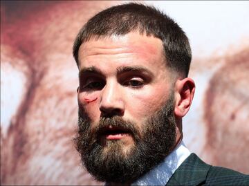 Así quedó el rostro de Caleb Plant tras la bronca con el 'Canelo' Álvarez