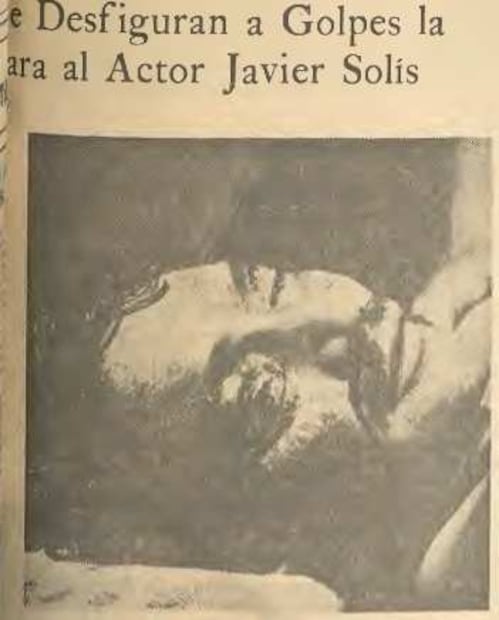 Javier Solís termina brutalmente golpeado en la que sería  su última pelea, en 1964.  
Hemeroteca EL UNIVERSAL.