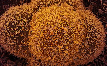 Covid-19: "Anticuerpos deshonestos", cuando nuestro propio cuerpo juega sucio