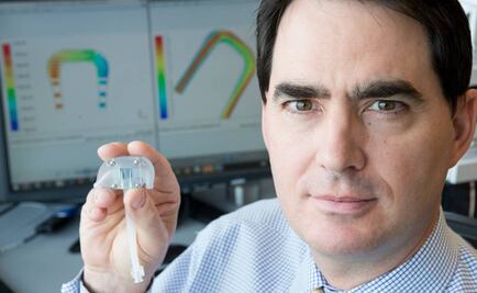 Conoce el riñón biónico