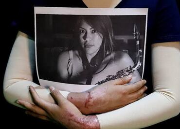 CDMX publica "Ley Malena"; ataques con ácido u otros químicos serán considerados tentativa de feminicidio