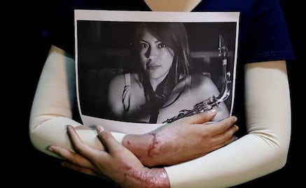 CDMX publica "Ley Malena"; ataques con ácido u otros químicos serán considerados tentativa de feminicidio