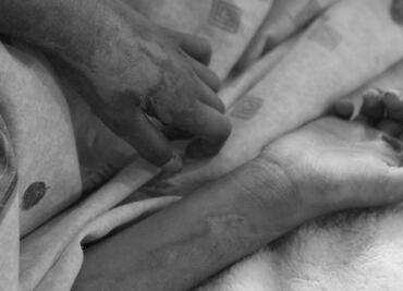 Explosión de barril con pólvora provoca la muerte de un niño y quemaduras graves en otros 5 menores en Guerrero