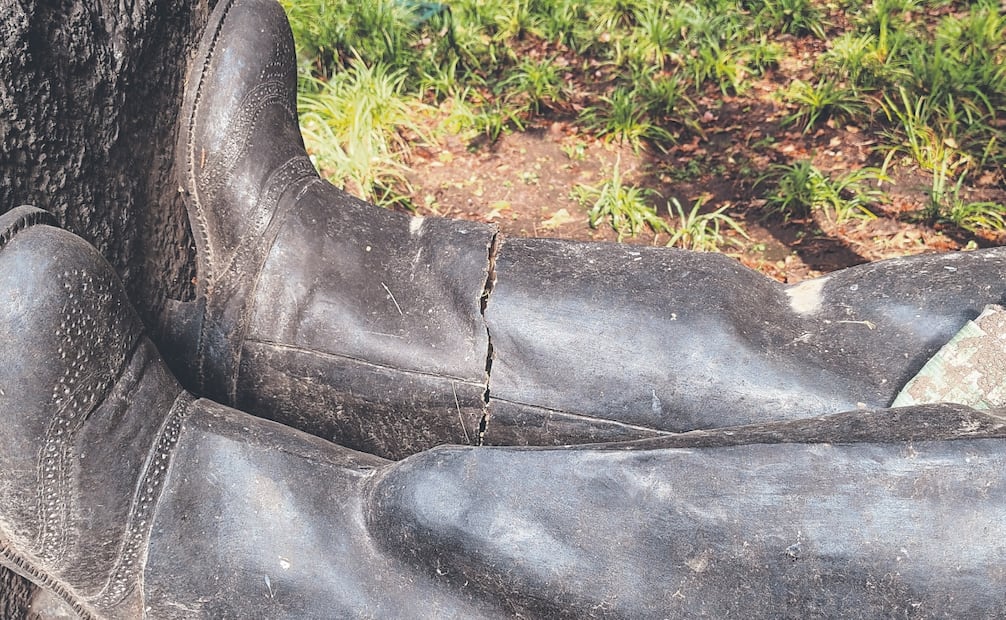 
El daño más notorio, además de la suciedad, es una abertura a la altura del tobillo derecho.  Foto: Cristopher Cabello/ EL UNIVERSAL