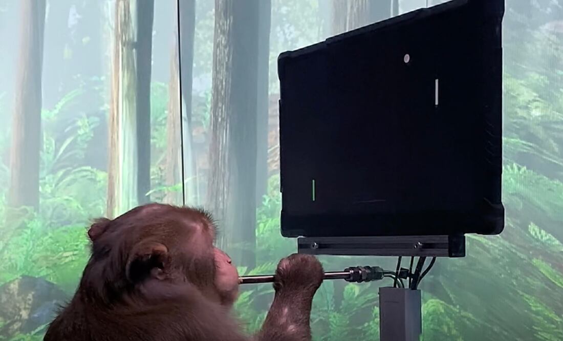 Foto: Neuralink vía Twitter