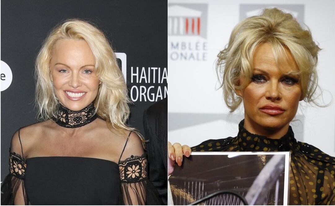 Algunas celebridades de Hollywood han tratado de revertir el paso del tiempo a través de intervenciones. Pamela Anderson sorprendió en un evento al lucir un rostro sospechosamente rejuvenecido  FOTO: ARCHIVO