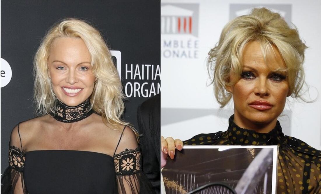 Algunas celebridades de Hollywood han tratado de revertir el paso del tiempo a través de intervenciones. Pamela Anderson sorprendió en un evento al lucir un rostro sospechosamente rejuvenecido FOTO: ARCHIVO