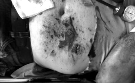 Explosión de caja de galletas en Lindavista lesiona a hombre