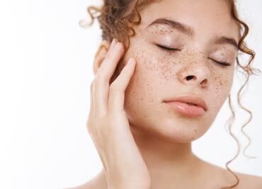 Colágeno natural: descubre el tubérculo que incrementa su producción y elimina las manchas de la piel