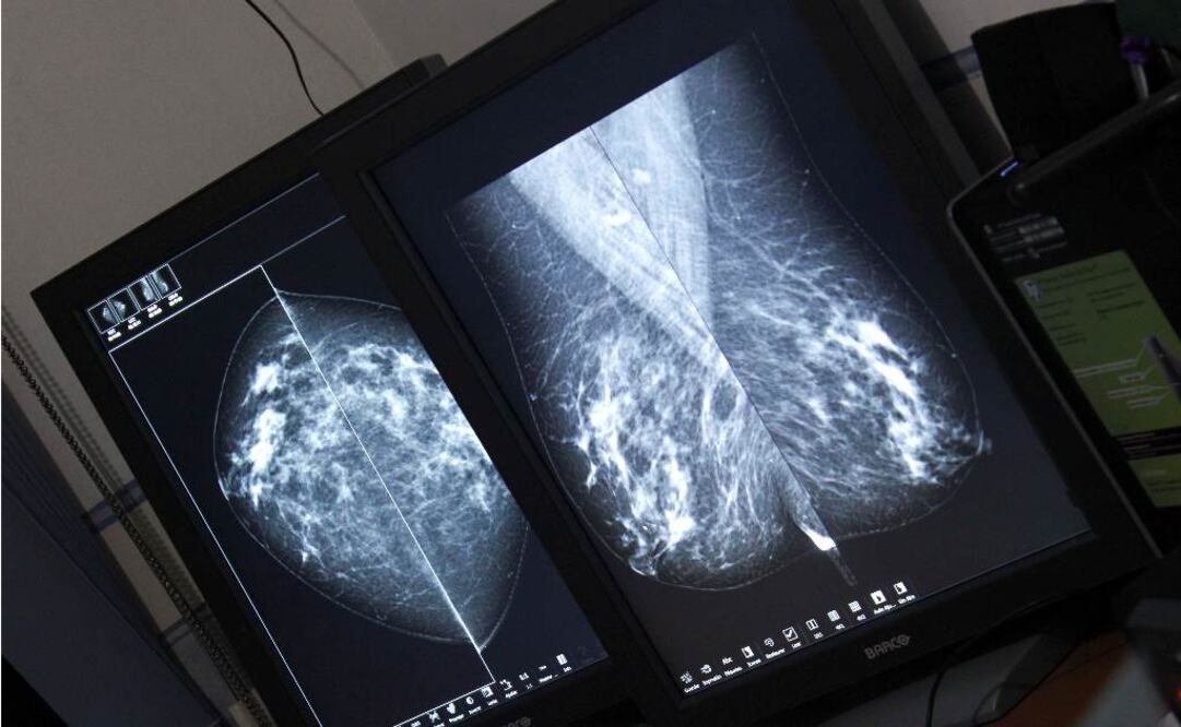 Archivo / EL UNIVERSAL