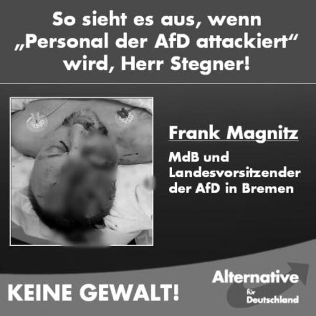 Hieren a diputado de extrema derecha de Alemania en ataque político