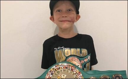 Niño que defendió a su hermana de un perro, recibe cinturón del CMB