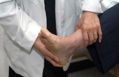 Conoce las principales causas del dolor de talón