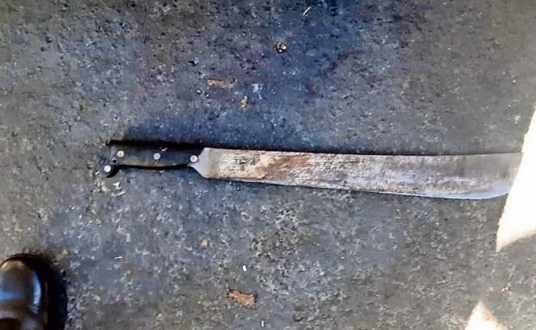 Ambos pelearon con un machete y un hacha luego de que el sujeto de 65 años golpeara a una mujer y llegara su hijo a defenderla. Foto ilustrativa: Archivo/EL UNIVERSAL  