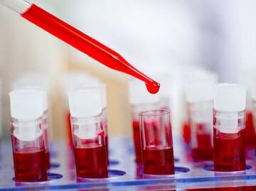 El extraordinario caso de la paciente argentina que "eliminó el VIH sin tratamiento"