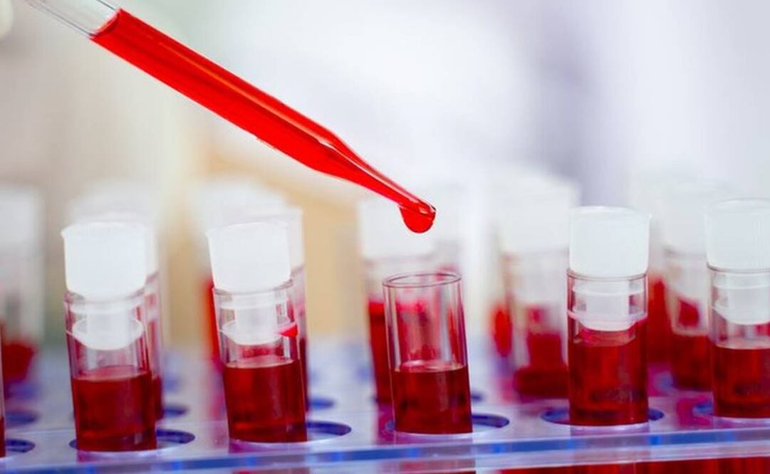 El extraordinario caso de la paciente argentina que "eliminó el VIH sin tratamiento"