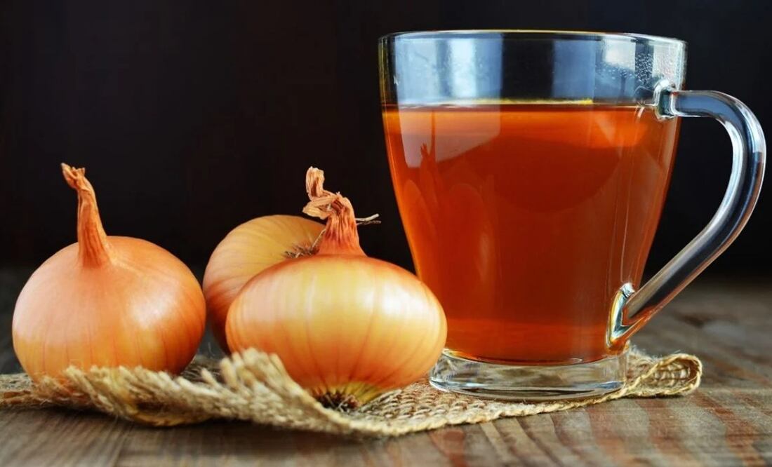 Comer cebolla favorece la salud renal. Foto: Freepik