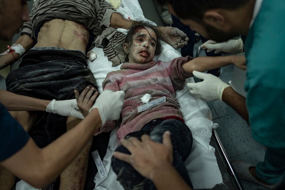 Palestinos heridos en el bombardeo israelí de la Franja de Gaza, al llegar a un hospital en Rafah. Foto: AP