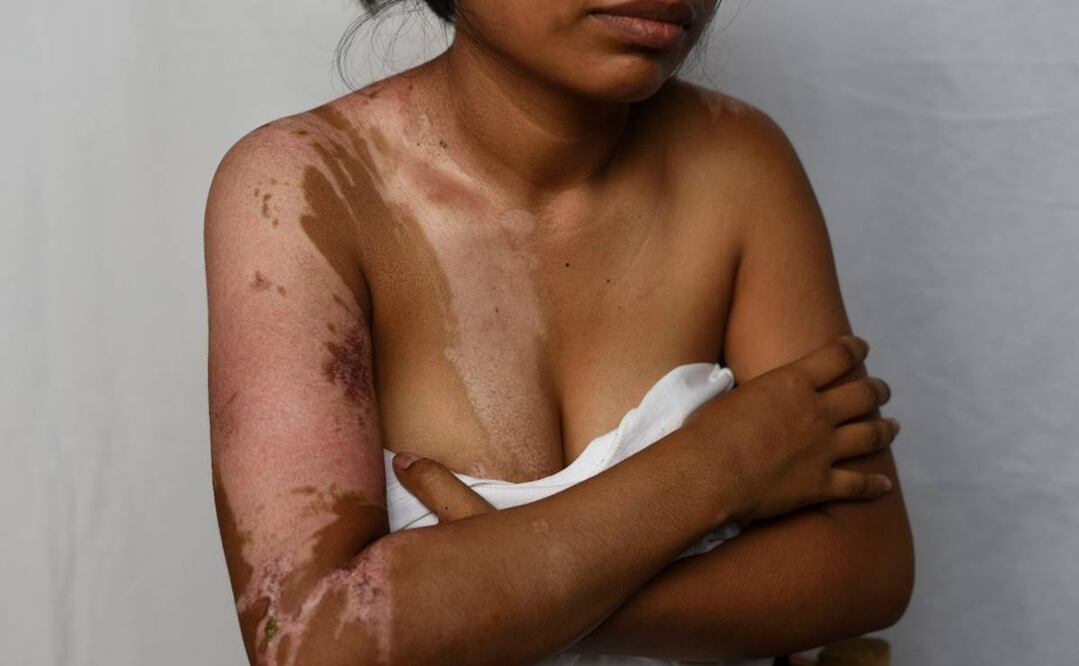 Fotos: Salvador Cisneros/EL UNIVERSAL