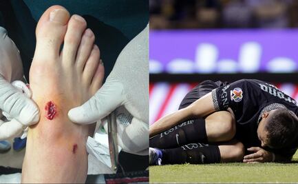 América pide que castiguen a Luis Enrique Santander y jugador del Puebla