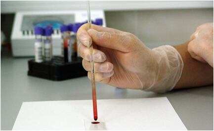 Profeco te dice dónde es más barato el examen de antígeno prostático