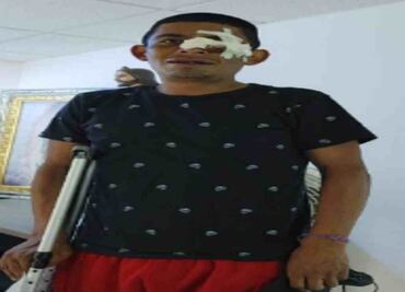 Dan de alta a comerciante en silla de ruedas golpeado frente a Bellas Artes por presunto cobro de piso