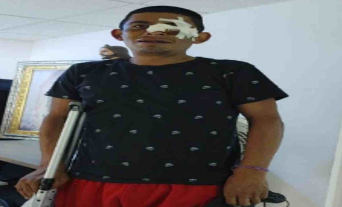 El altercado entre comerciantes ambulantes se debió por un presunto cobro de piso. Foto: Especial