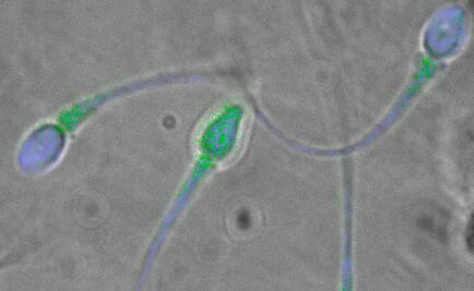 Consumo de alcohol afecta fertilidad en hombres