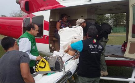 Niño de tres años es atacado por pitbull en Hidalgo