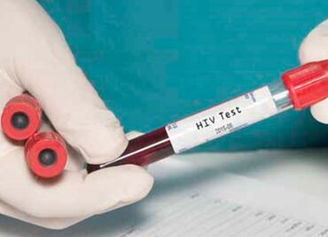 OMS preaprueba dos test para detectar VIH en bebés