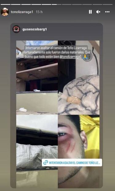 Trataron de asaltar el autobús de Toño Lizárraga: un músico salió herido