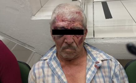 Adulto mayor mata a tiros a agente de tránsito en Naucalpan 