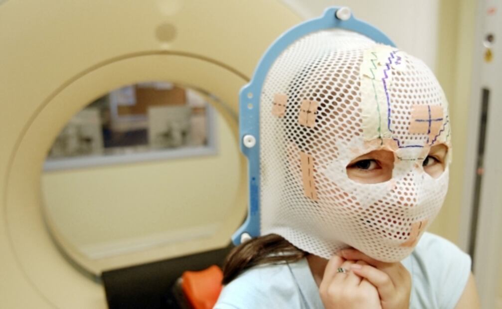 Identifican al culpable de la malignidad del cáncer de cabeza