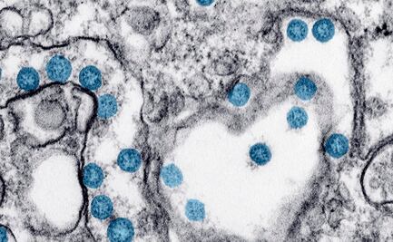 Este fármaco reduce el riesgo de Covid-19 en un 57%, dice estudio