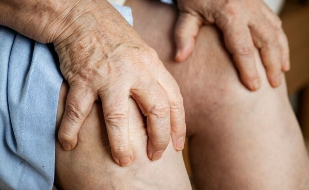 Trombosis y viajes largos. Fuente: Freepik