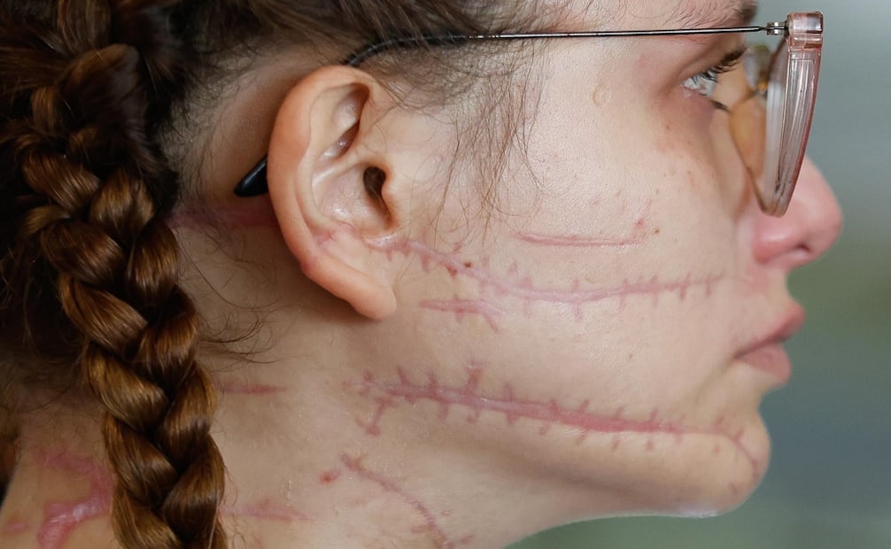 Sobreviviente de intento de feminicidio denuncia amenazas. Foto: Diego Simón