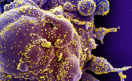 Supervivencia del coronavirus varía según humedad, temperatura y superficie