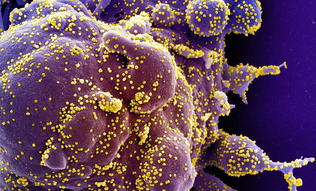 Foto: EFE/EPA/NIAID/NATIONAL INSTITUTES OF HEALTH HANDOUT