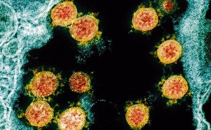 ¿Qué es el suero equino y cuál es su relación con el Covid-19?