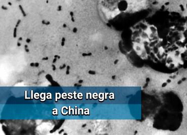Región de China declara alerta preventiva por un caso de peste bubónica