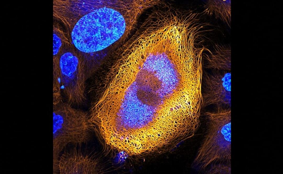 El primer premio fue para la foto de una célula de piel humana, aumentada 40 veces, tomada por un grupo de investigadores del Instituto Holandés del Cáncer. 