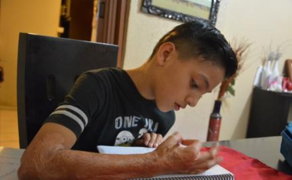 Su motivación es ir al campamento