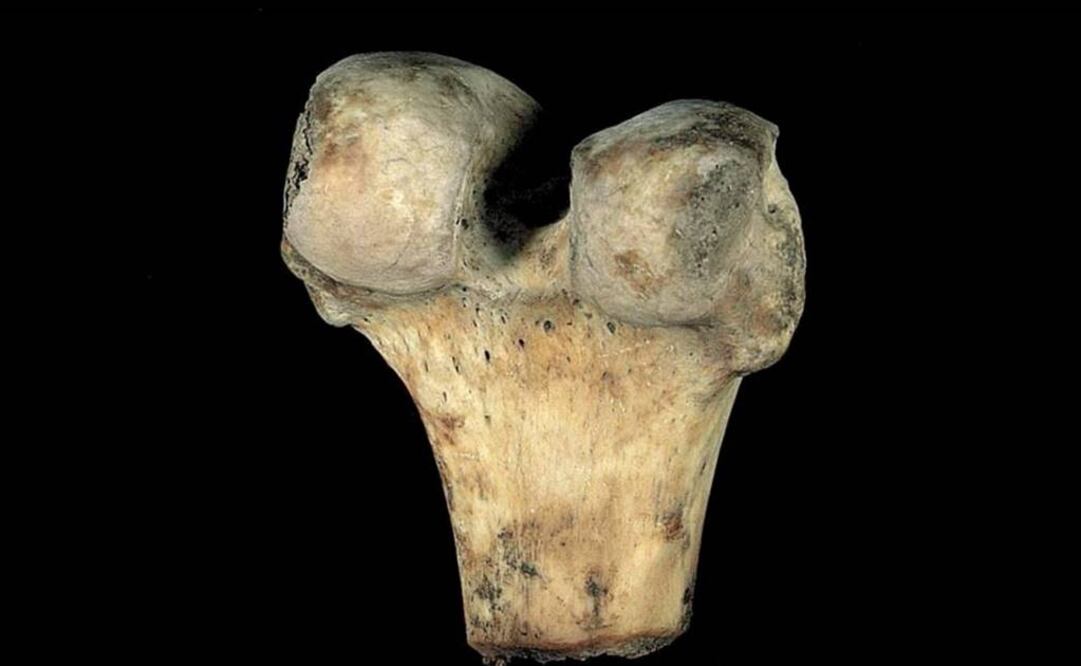 Con el proceso de material se puede elaborar un biovidrio que puede favorecer el trabajo de las células. (FOTO: Archivo EL UNIVERSAL) 