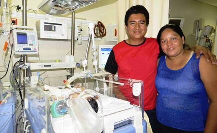 Realizan con éxito primer cateterismo a bebé en Chiapas