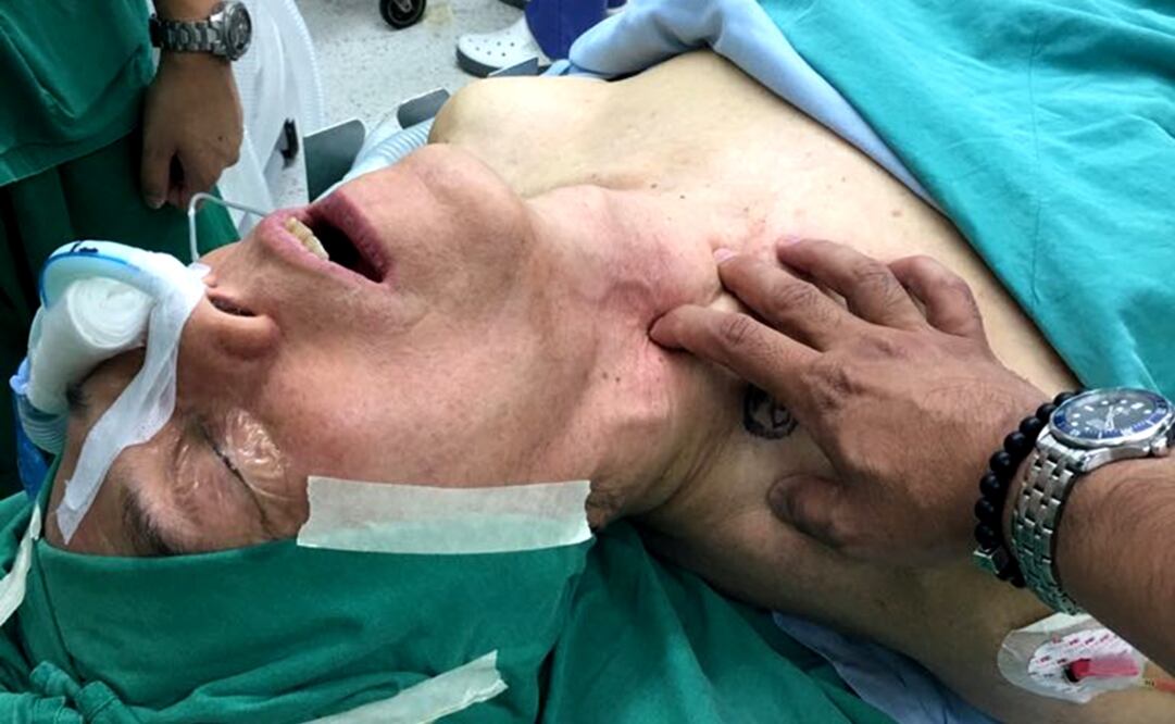 La tiroides es una glándula multifuncional. Foto: Especial