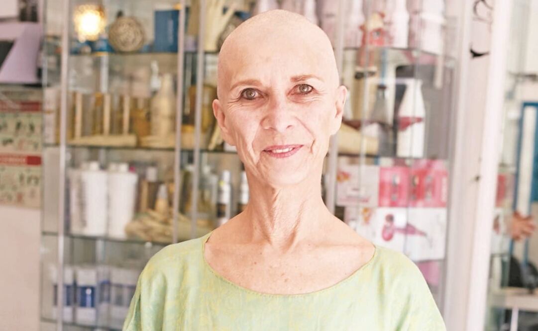 Paloma asegura que no tiene problema de andar sin pelo por la calle. (FOTOS: AGUSTÍN SALINAS. EL UNIVERSAL)