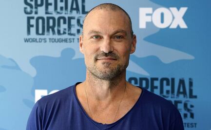 Brian Austin Green, ex de Megan Fox, tuvo síntomas de un derrame cerebral por culpa de una dieta