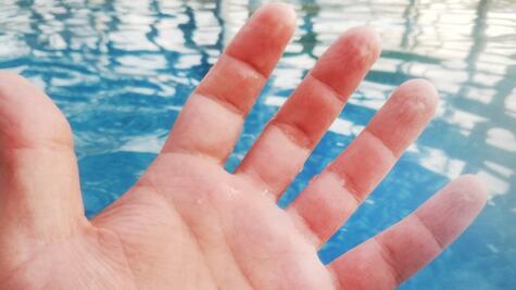 ¿Qué revelan de nuestra salud las arrugas de los dedos cuando se humedecen? 