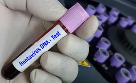 OMS declara fin del brote de hantavirus; se registraron 13 casos relacionados con un crucero que zarpó de Argentina